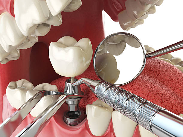 Best Emergency Tooth Extraction  in Adelphi, MD